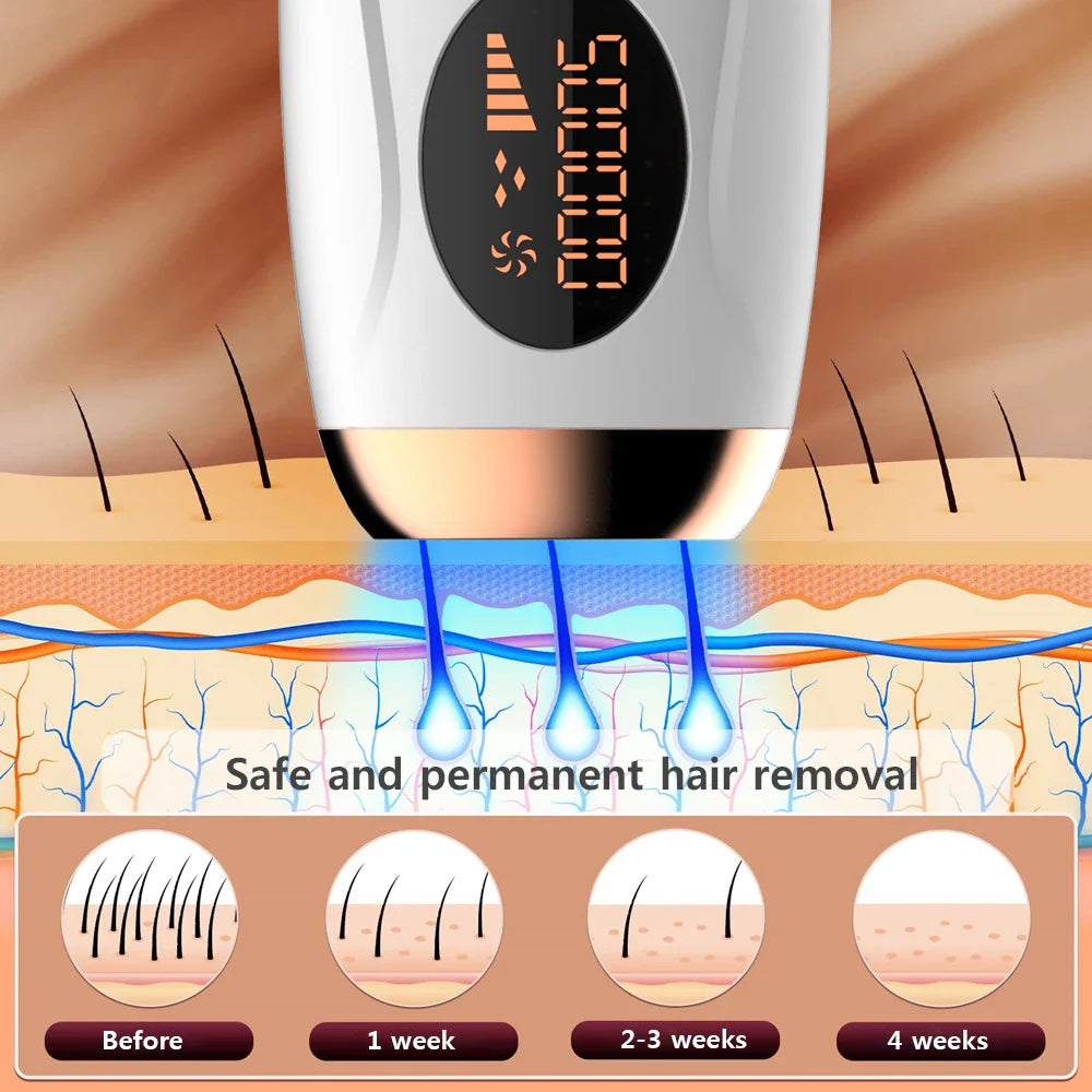 IPL Hair Removal — lifestyle